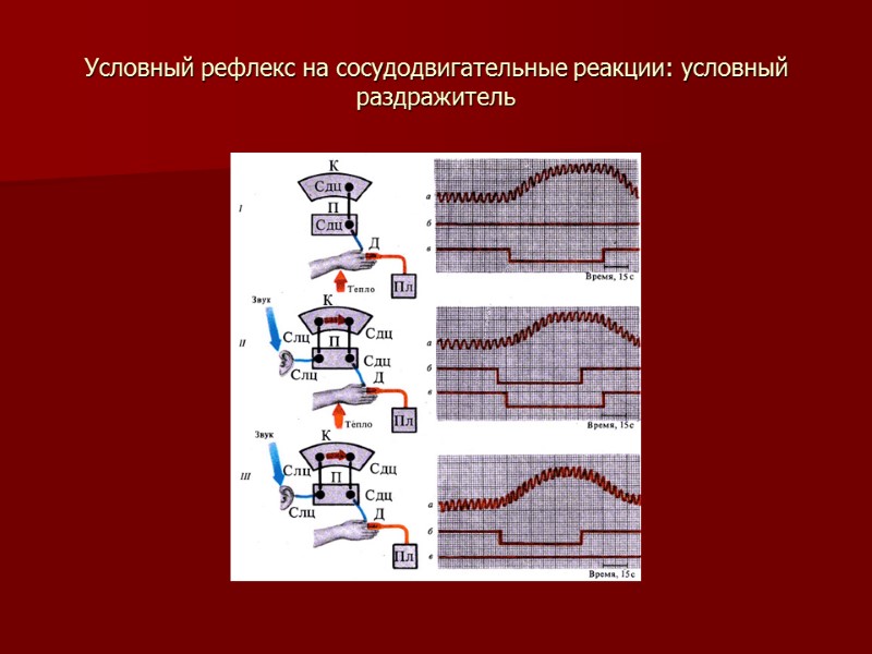 Условный рефлекс на сосудодвигательные реакции: условный раздражитель